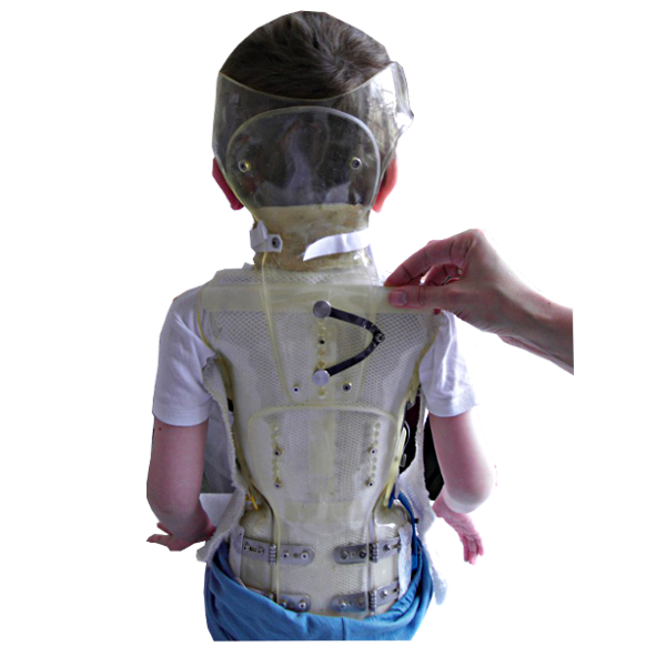 corset Garchois Corsets de traitement scoliose NEUT — free download